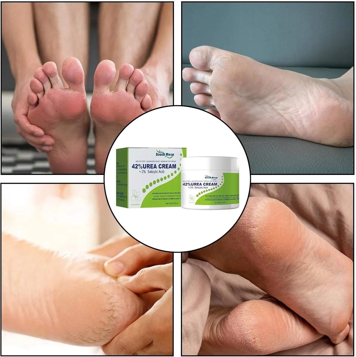 South Moon - 42% Urea Cream + 2% Salicylic Acid (Original)